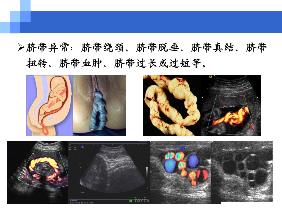 7)胎儿窘迫.ppt 第5页