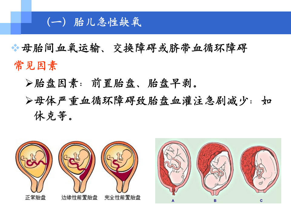 7)胎儿窘迫.ppt 第4页