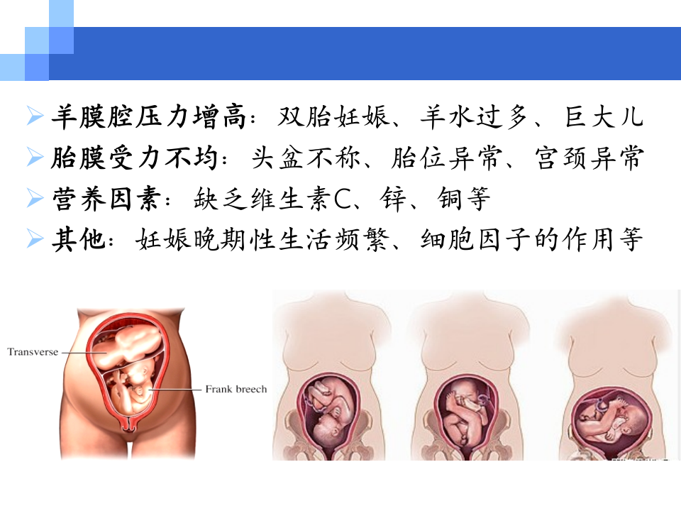 8)胎膜早破.ppt 第5页