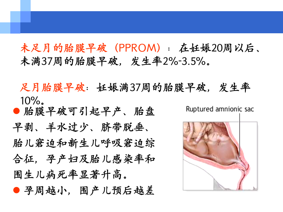 8)胎膜早破.ppt 第3页