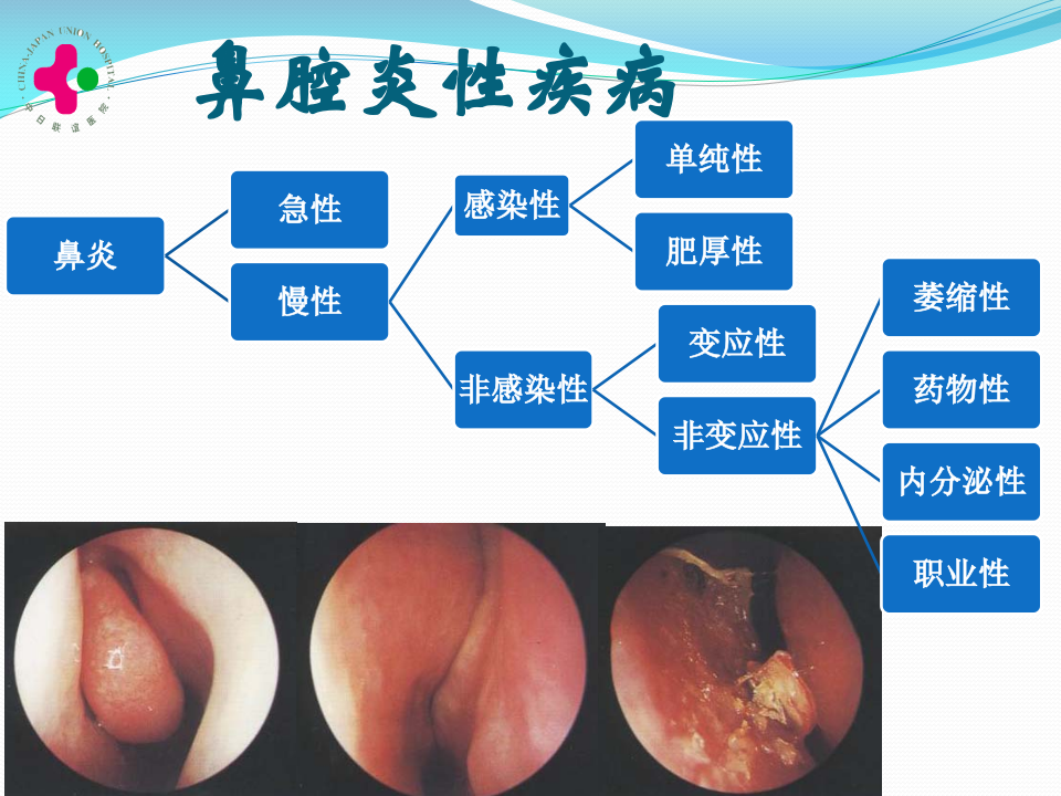 1)2011级临床口腔-慢性鼻炎变应性鼻炎鼻息肉-教室.ppt 第2页