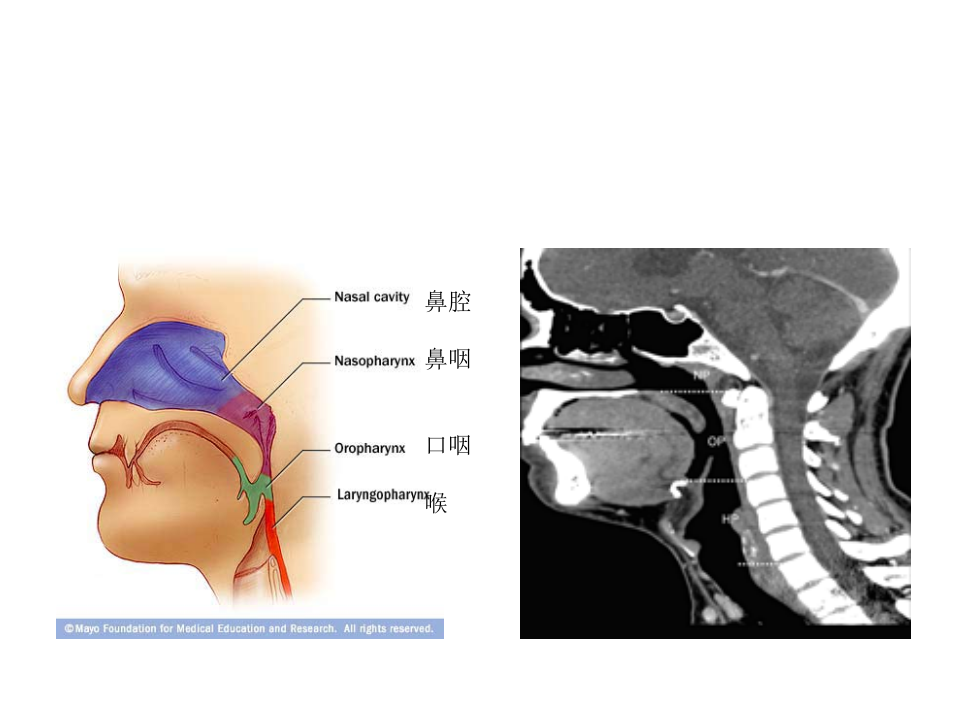 5)咽部解剖、扁桃体炎2015.ppt 第4页