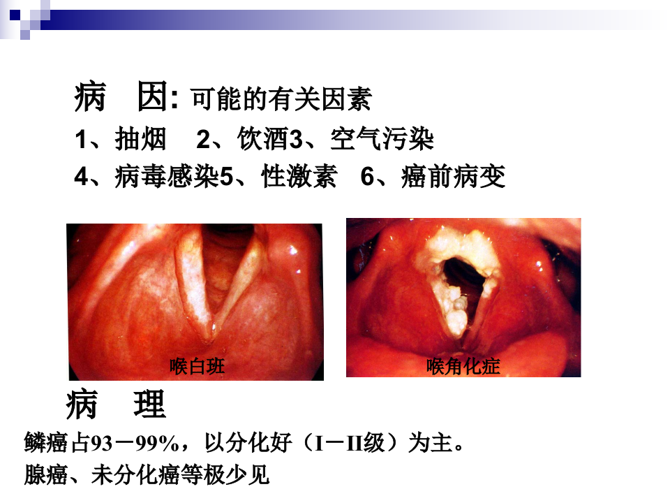 7)喉癌 喉阻塞 气管切开术2.ppt 第3页