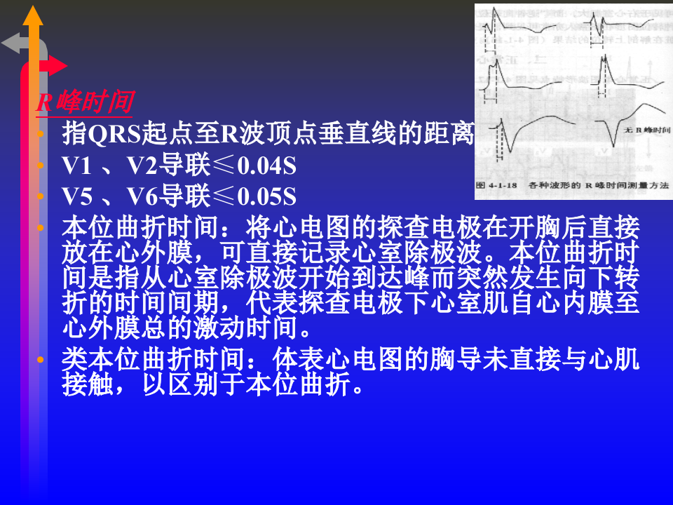 心电图－第二次课（3节）.ppt 第4页