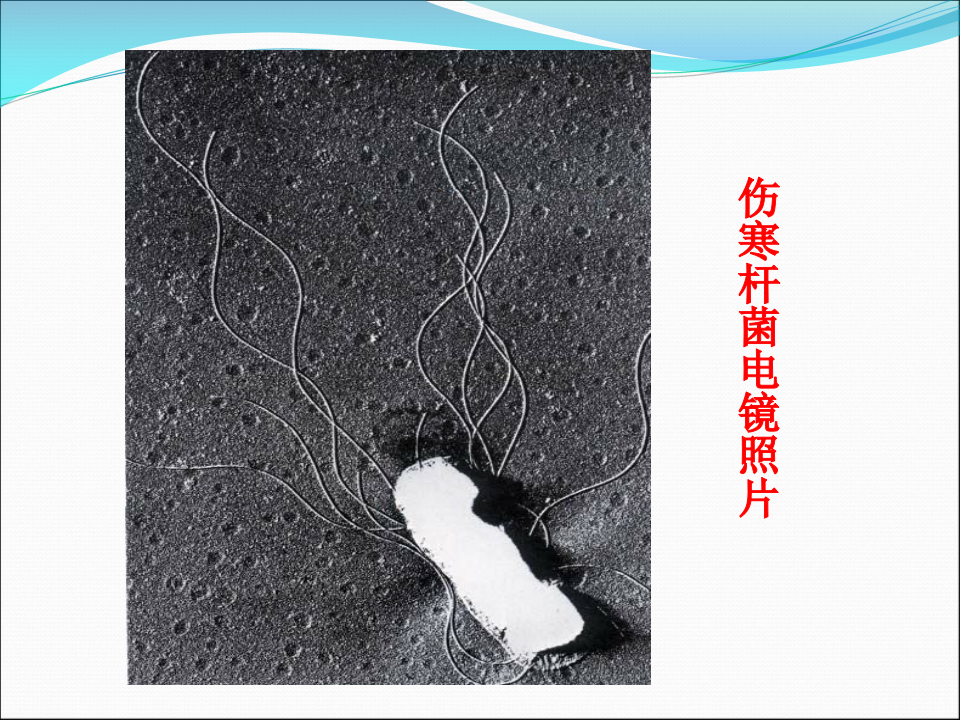 7)伤寒1.ppt 第5页