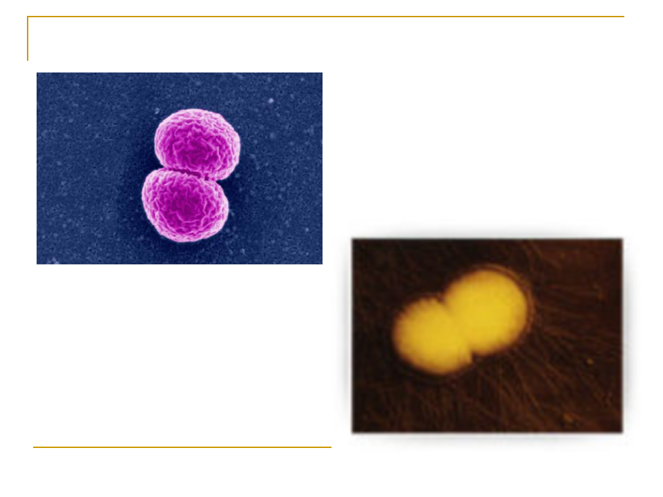 11)流行性脑脊髓膜炎.ppt 第5页