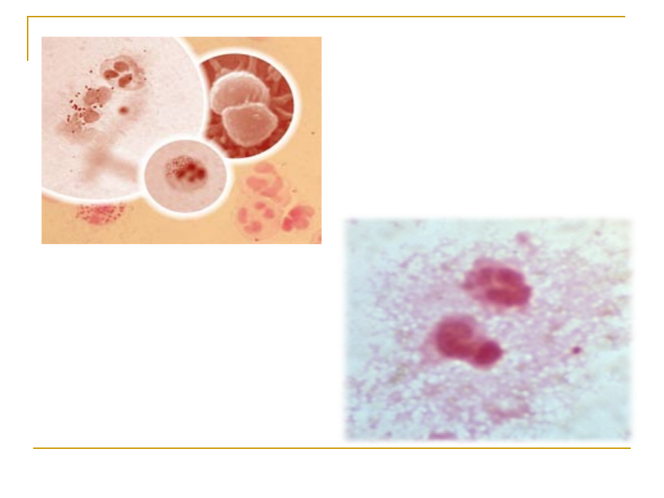 11)流行性脑脊髓膜炎.ppt 第4页