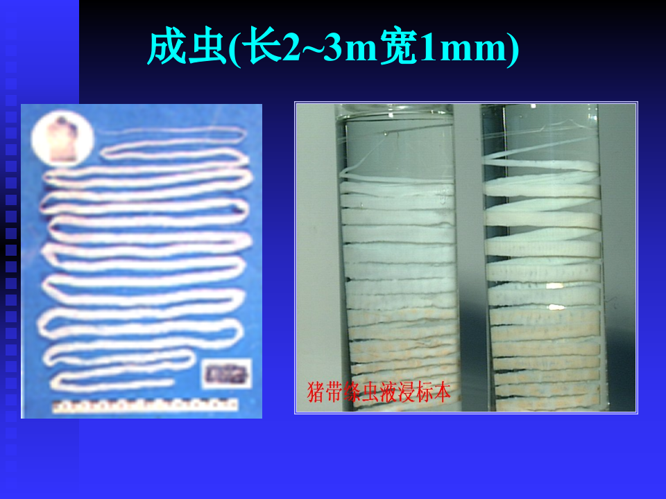 15)囊尾蚴病.ppt 第4页