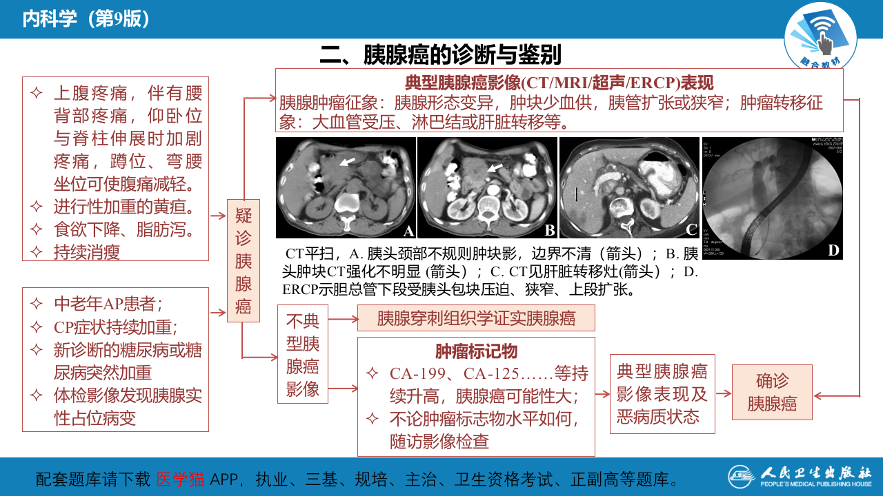 第二十一章  胰腺癌.pptx 第5页