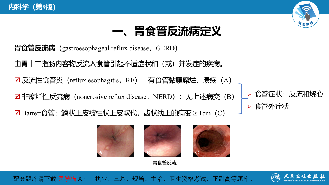 第二章  胃食管反流病.pptx 第4页