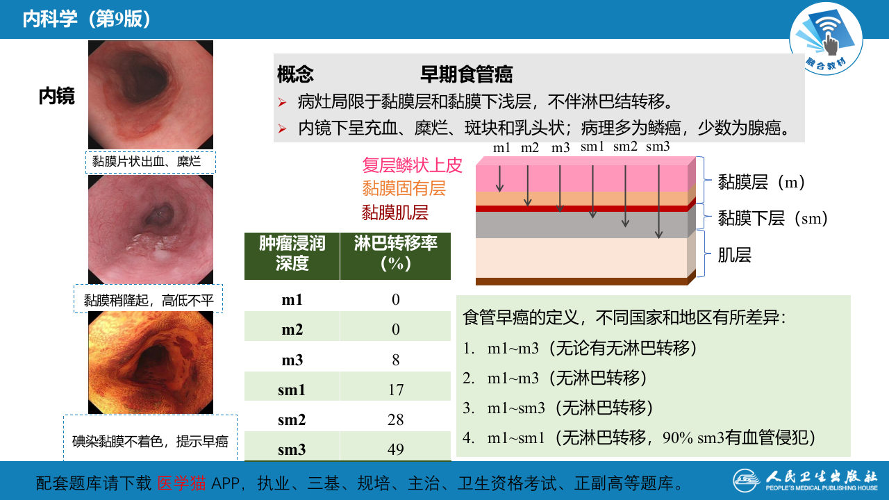 第三章  食管癌.pptx 第5页