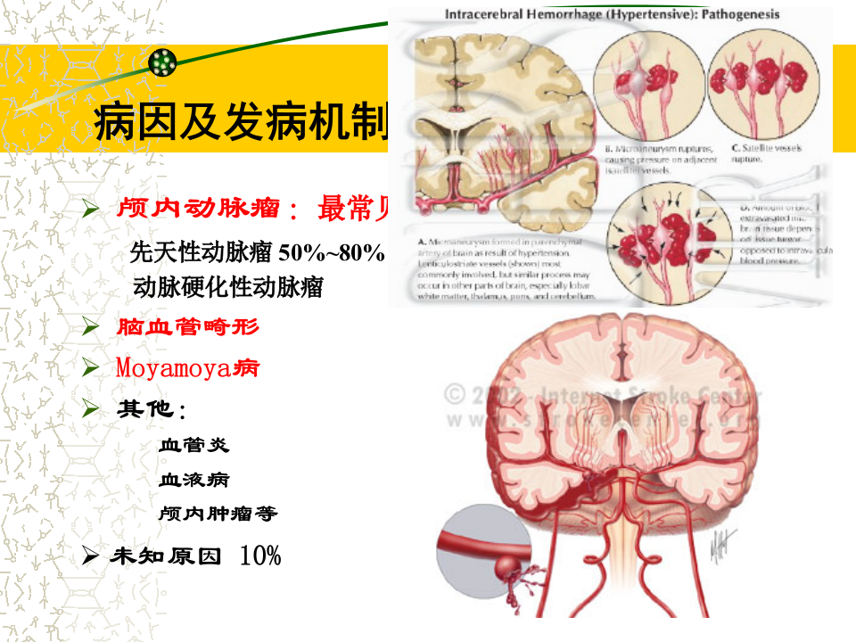 5)级放射口腔SAH.ppt 第3页