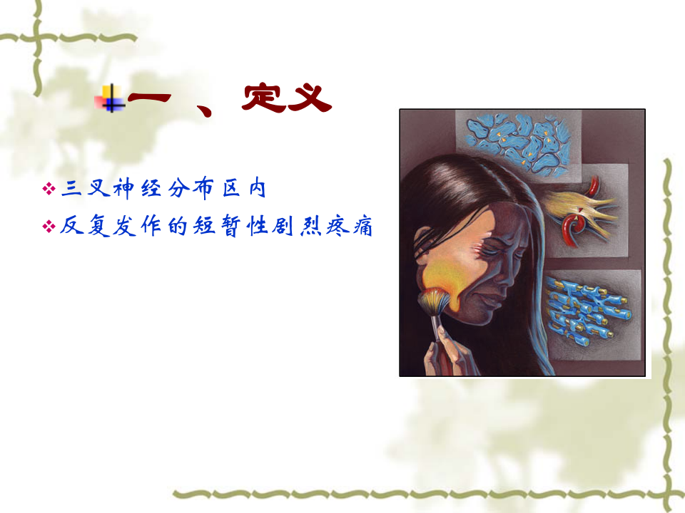 三叉神经痛修改.ppt 第2页