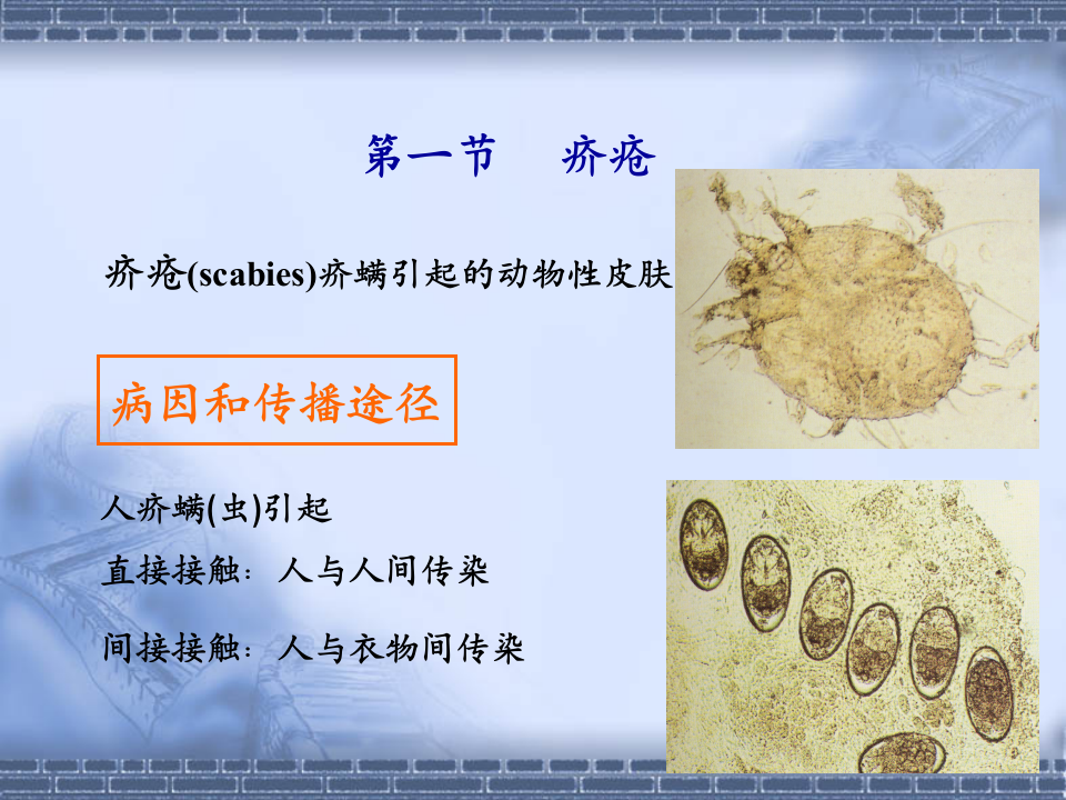 5)0624 湿疹类皮肤病本科生.ppt 第3页