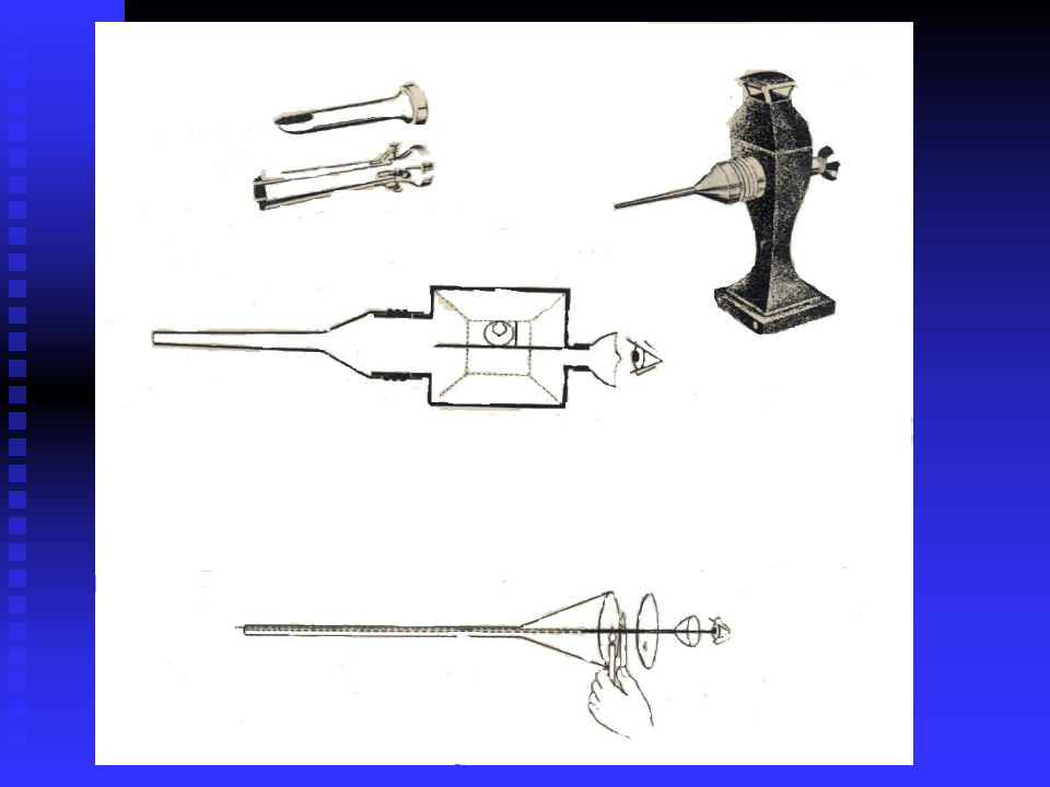 泌尿系梗阻双语版-湘雅二院张磊.ppt 第3页