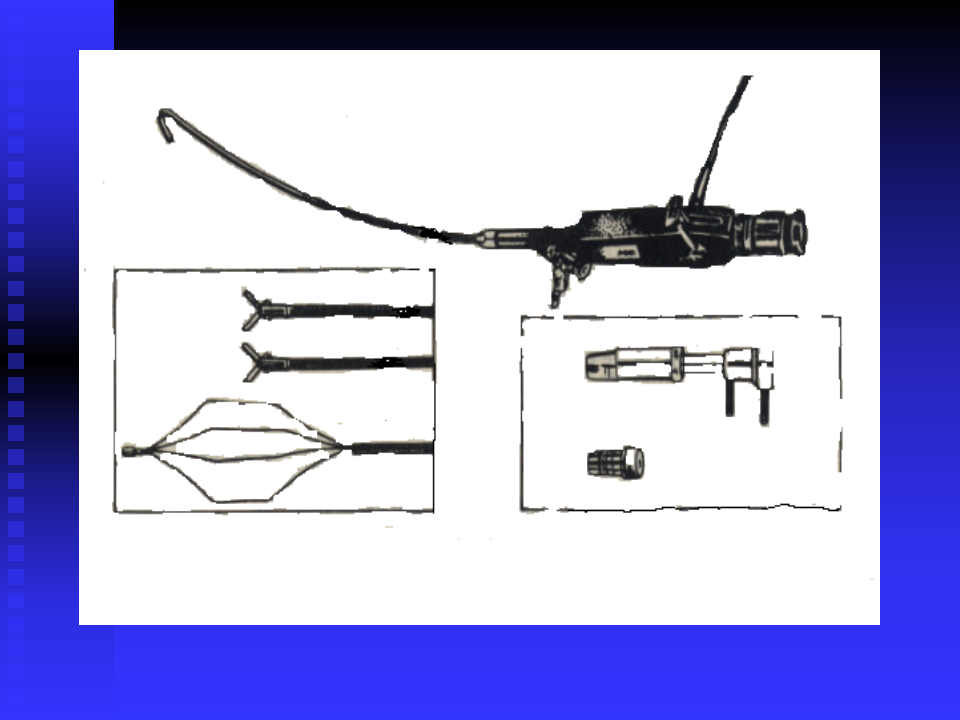 泌尿系梗阻双语版-湘雅二院张磊.ppt 第4页