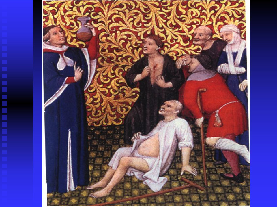 泌尿系梗阻双语版-湘雅二院张磊.ppt 第1页