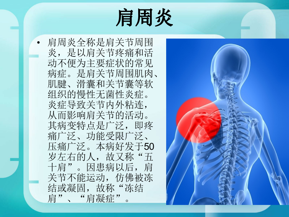 骨科-肩周炎.ppt 第1页