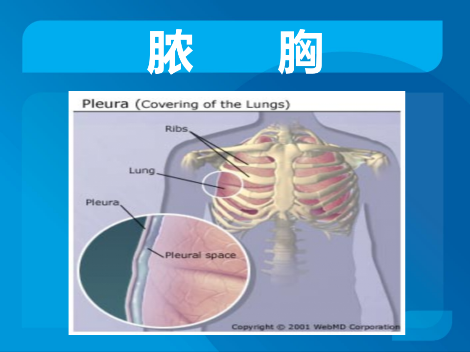传染科-脓胸.ppt 第2页