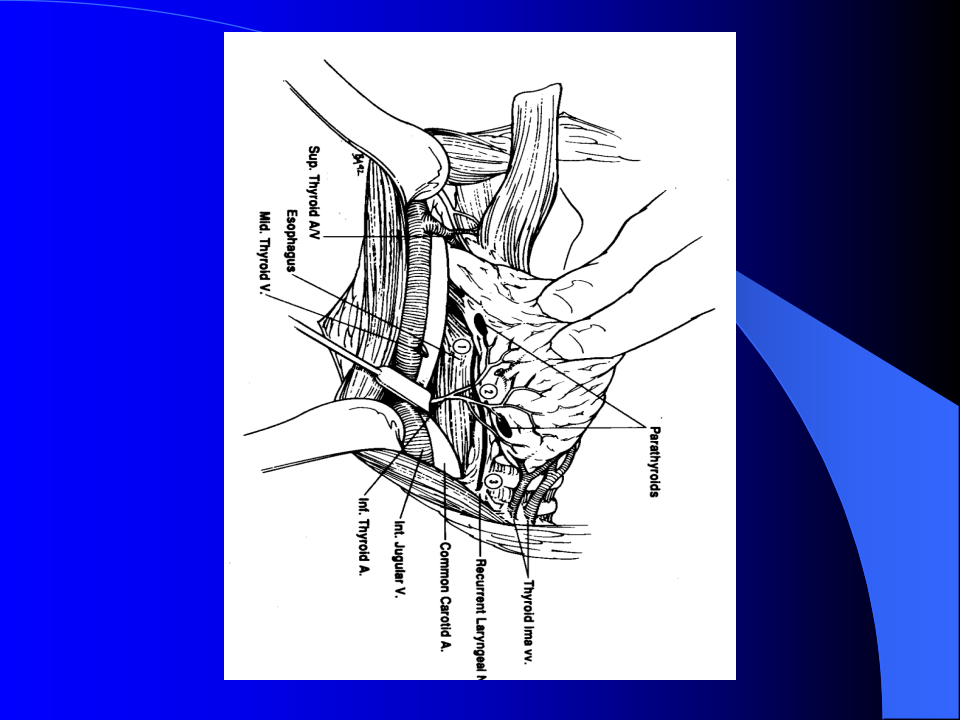 内分泌科-甲状腺和乳腺疾病的外科治疗.ppt 第5页