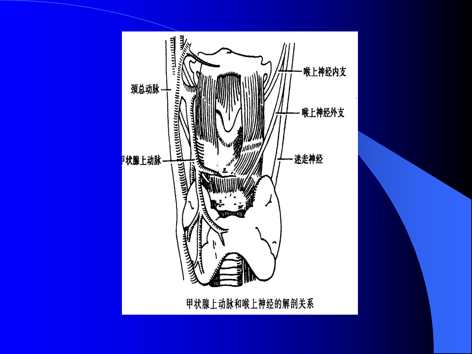 内分泌科-甲状腺和乳腺疾病的外科治疗.ppt 第3页