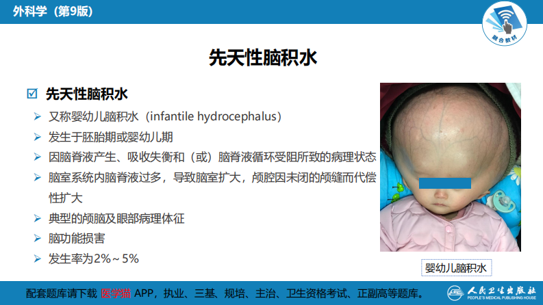 第二十一章 颅脑和脊髓先天畸形.pdf 第5页