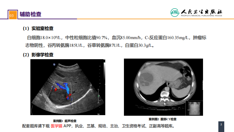 第三十八章 肝疾病 案例分析-肝脓肿.pdf 第5页