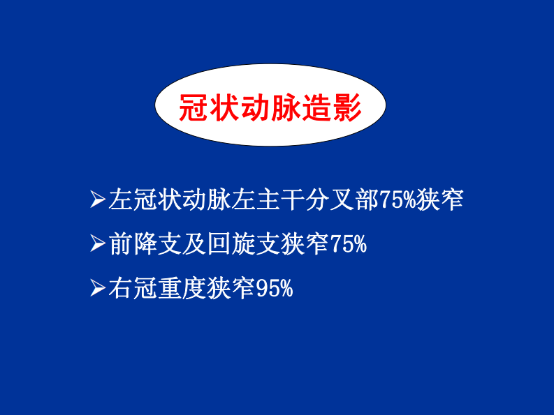 降低围术期风险措施的循证医学证据-上海讲课-part 3.pdf 第4页