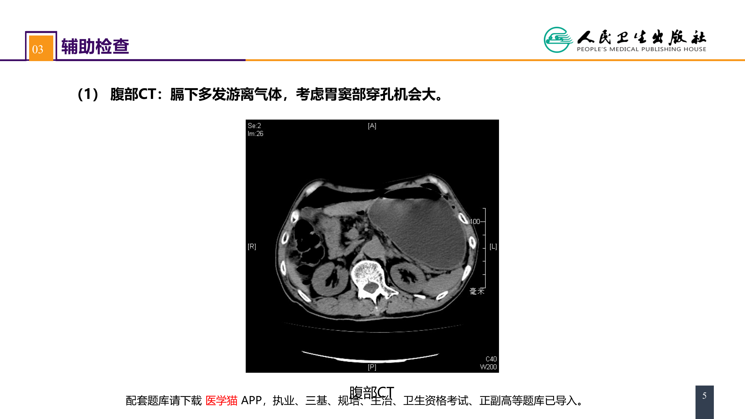 第三十四章 胃十二指肠疾病 案例分析-胃十二指肠溃疡伴穿孔.pptx 第5页