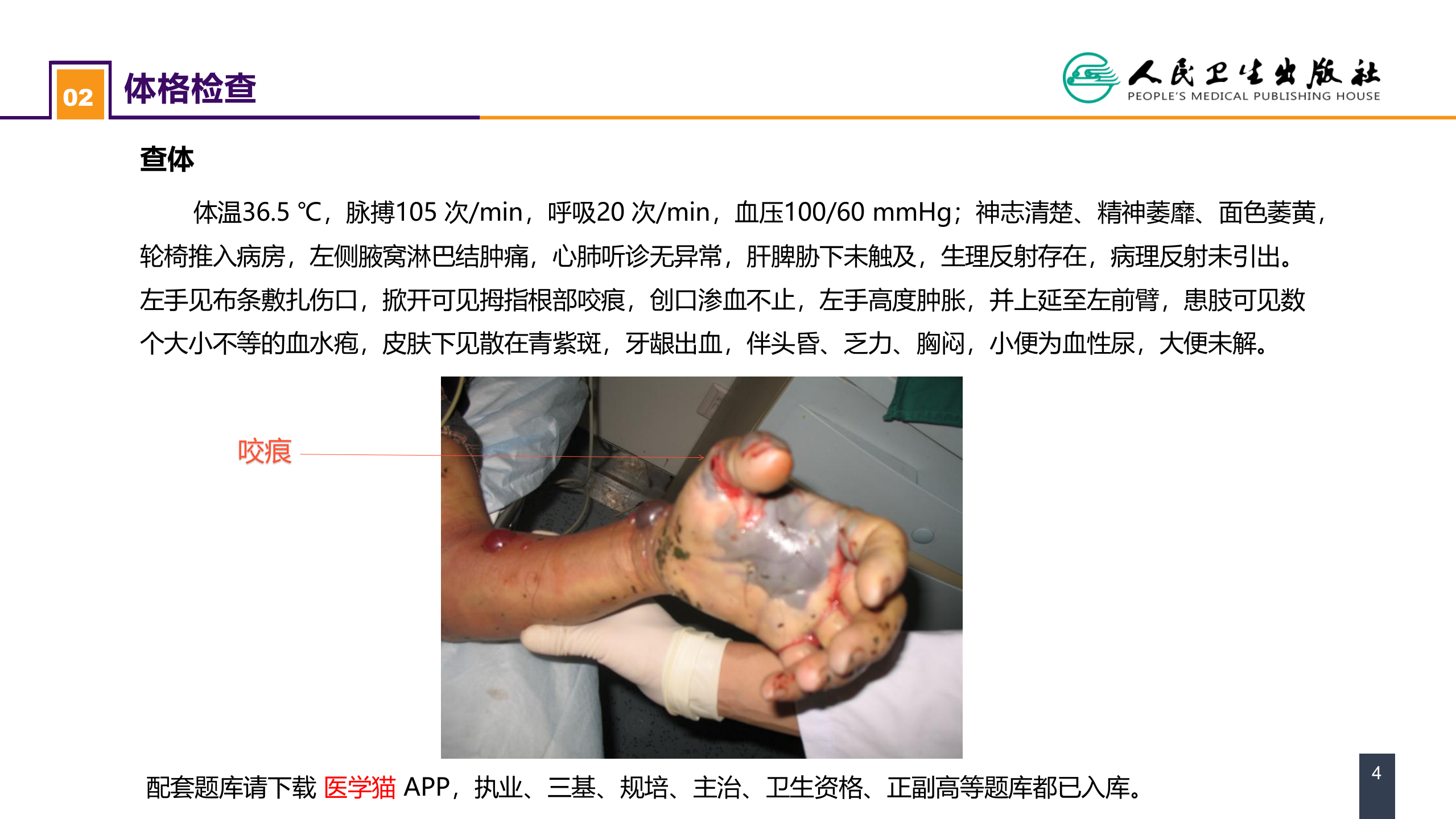 第十三章 烧伤、冻伤、蛇咬伤、犬咬伤、虫蛰伤 案例分析-蛇咬伤.pptx 第4页