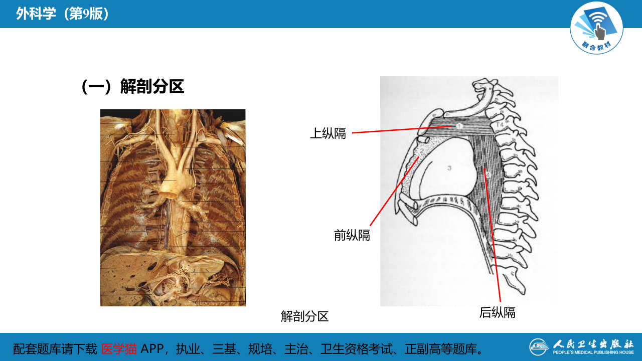 第二十八章 原发性纵隔肿瘤.pptx 第4页