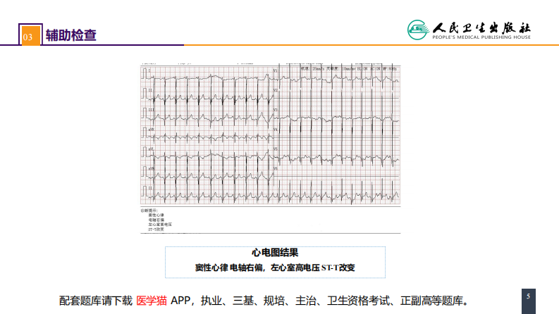 第二十九章 心脏疾病 案例分析-室间隔缺损.pdf 第5页