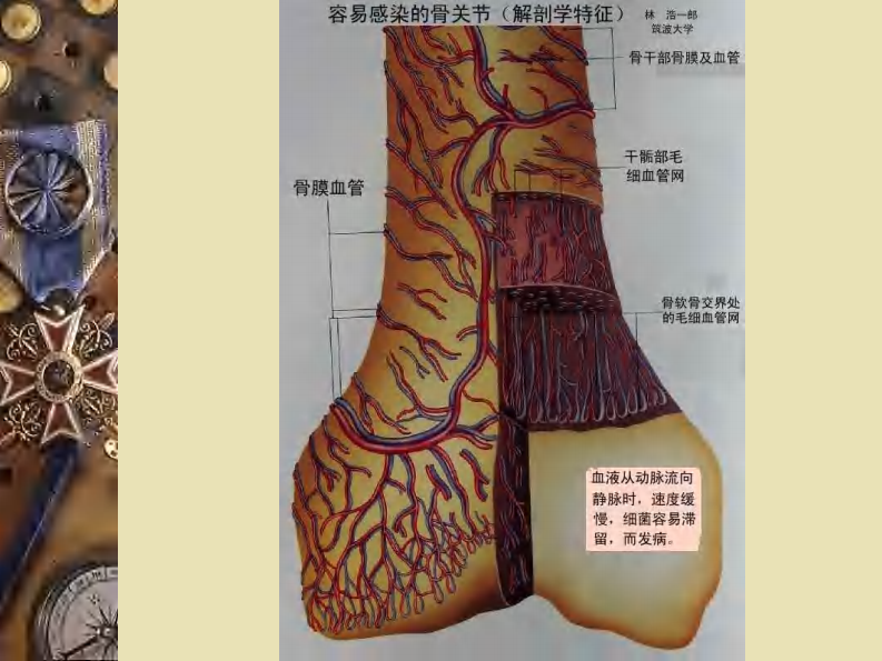 骨科-骨与关节感染.pdf 第5页