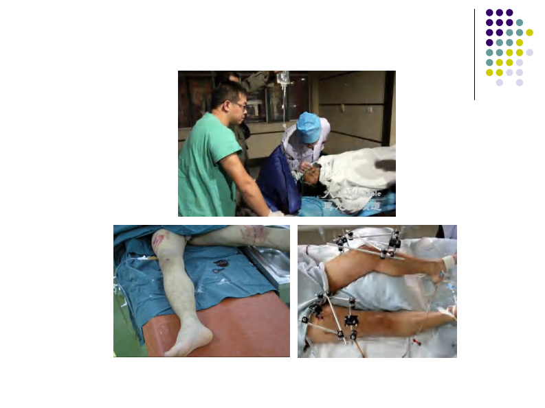 骨科-骨折总论-.pdf 第4页