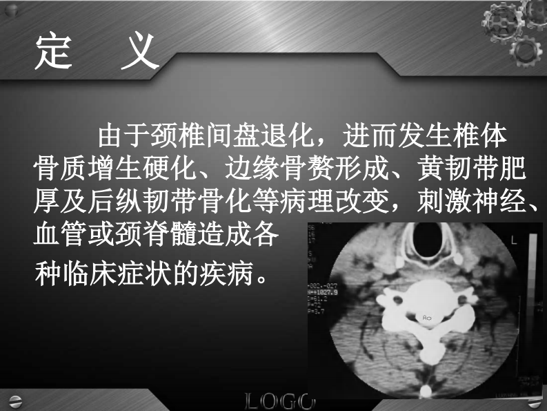 骨科-颈椎病详解.pdf 第4页