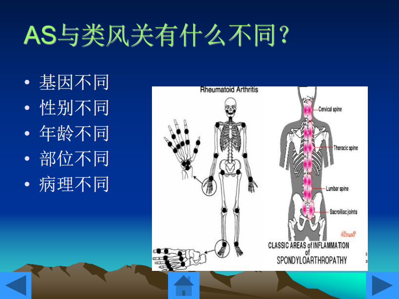 骨科-强直性脊柱炎的护理.pdf 第4页