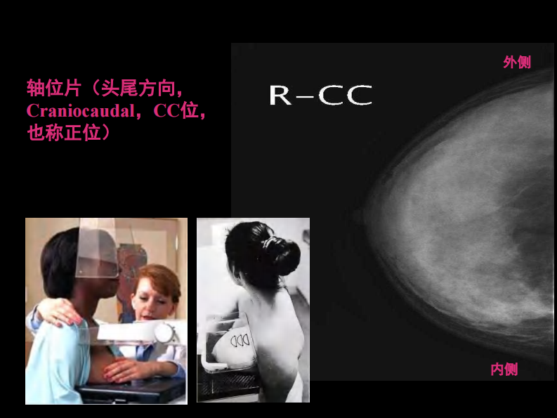 乳腺影像学检查与诊断.pdf 第5页