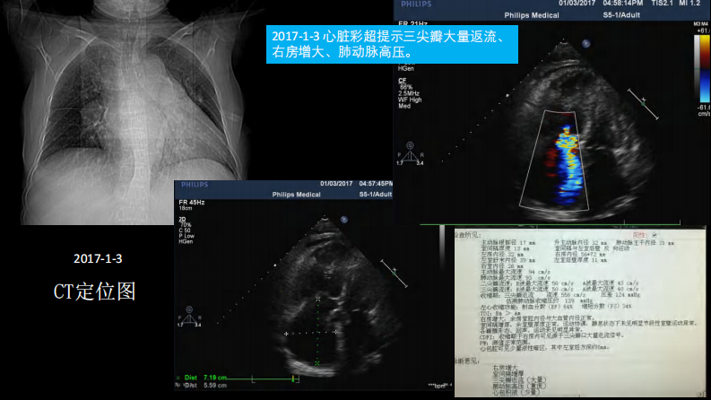 胸部影像解读：心肺一体性疾病.pdf 第4页