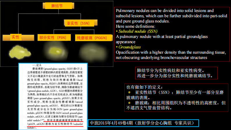 (已瘦身)肺结节指南与临床实践.pdf 第5页
