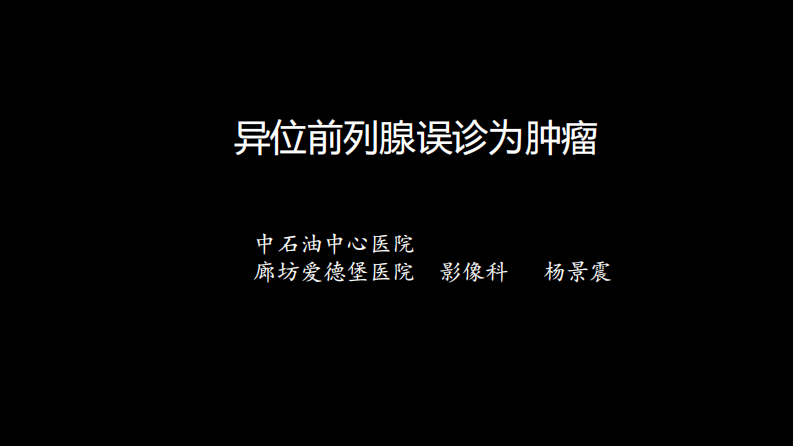 异位前列腺误诊为肿瘤.pdf 第1页