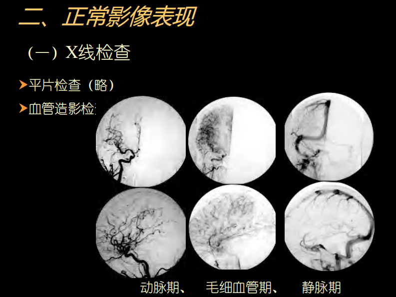 中枢神经(脑、脊髓)影像诊断.pdf 第5页