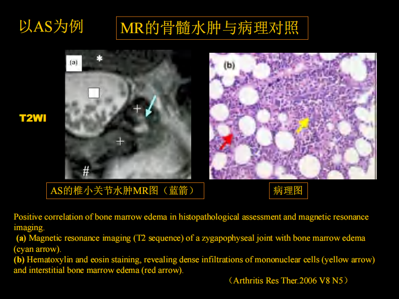 骨与关节常见病影像诊断.pdf 第5页