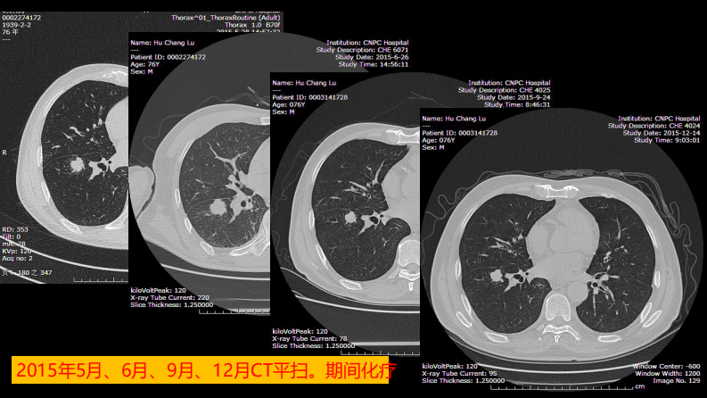 这例肺部病灶的比较影像学：价值评判.pdf 第4页