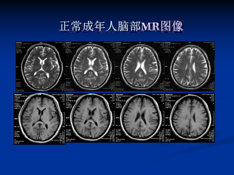 新生儿缺氧缺血性.pdf 第4页