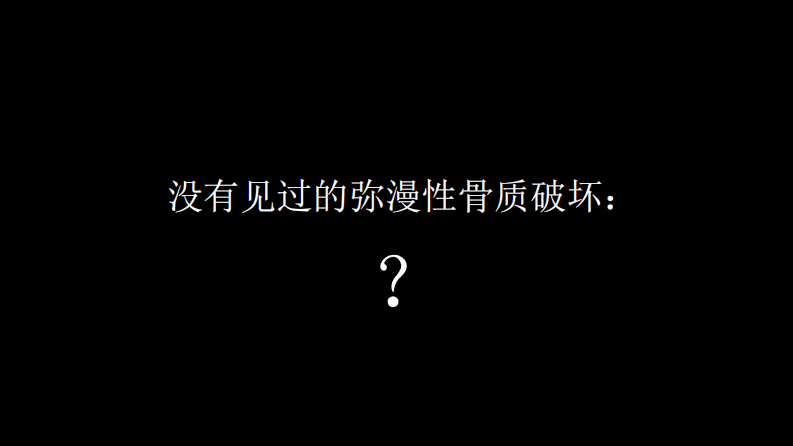 没有见过的弥漫性的骨质破坏.pdf 第1页