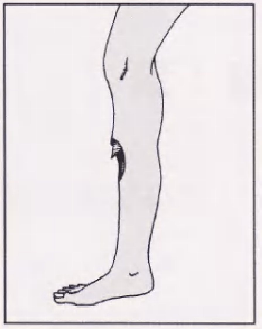 实用骨折治疗学（美）（全图版）.pdf 第2页