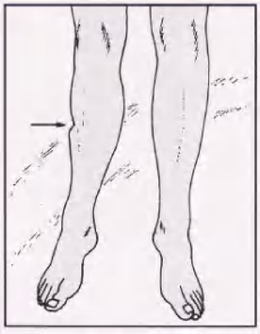 实用骨折治疗学（美）（全图版）.pdf 第3页