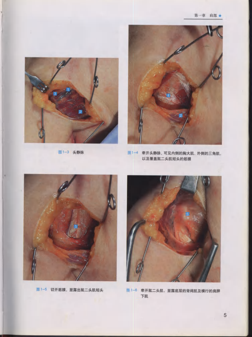 骨科手术入路图谱（中文高清彩图版）.pdf 第5页