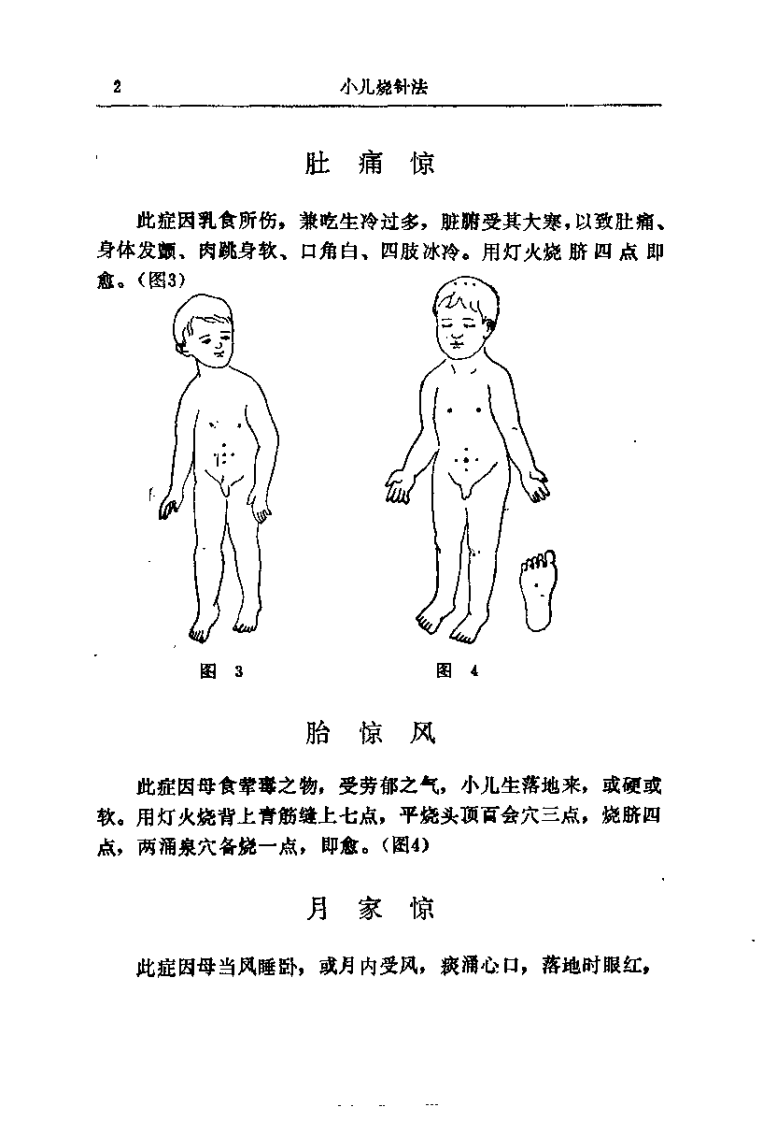 [小儿烧针法].王君萃.扫描版.pdf 第3页