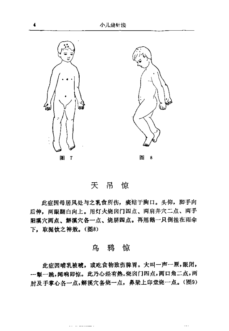 [小儿烧针法].王君萃.扫描版.pdf 第5页